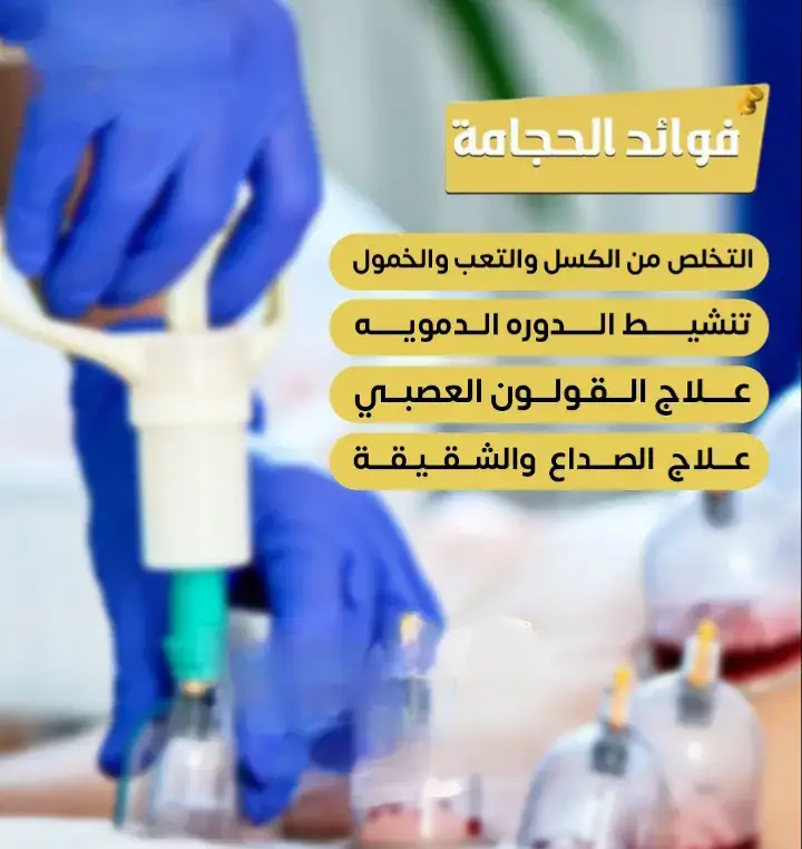 ##الحجامة #اكسبلور #fyp #متابعة_قلب_تعليق_مشاركة_ ##اكسلبورر_explore