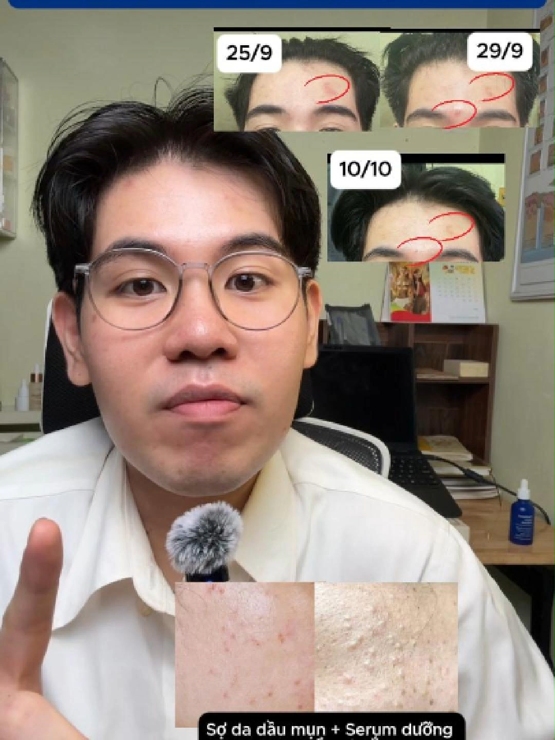 Serum B5 làm dịu phục hồi giảm đỏ phân khúc hssv hạt dẻ đến đây! Cuối năm rồi, mình quyết định đưa các sp bình dân mà hiệu quả đến cho mn thêm option dưỡng da đón Tết nha #duduocsi #serum  #b5labonita #phuchoi #capam #treatment