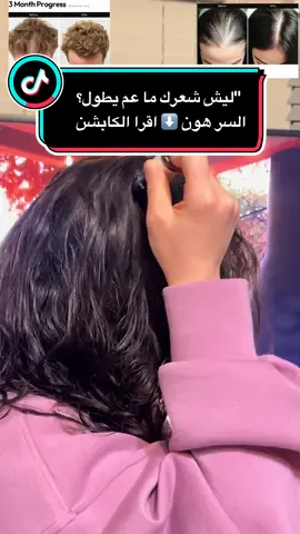 #@BIGVITA - Health  	•	يقوّي الشعر ويخفف التساقط 💪 	•	يرطّب ويغذي الأطراف ✨ 	•	يعطي لمعان ونعومة فوراً 🌟 	•	يحمي الشعر من التقصف والتلف #نجمة_تيك_تو #محتوى_مفيد # 	•	سهل الاستعمال ومناسب لكل أنواع الشعر #BIGVITA ##Sh#روتيني_اليومي 