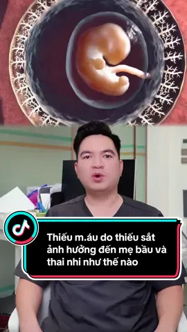 Thiếu m.áu do thiếu sắt ảnh hưởng đến mẹ bầu và thai nhi như thế nào #education #bacsinampshn #thainhi #mangthai #thieusat 
