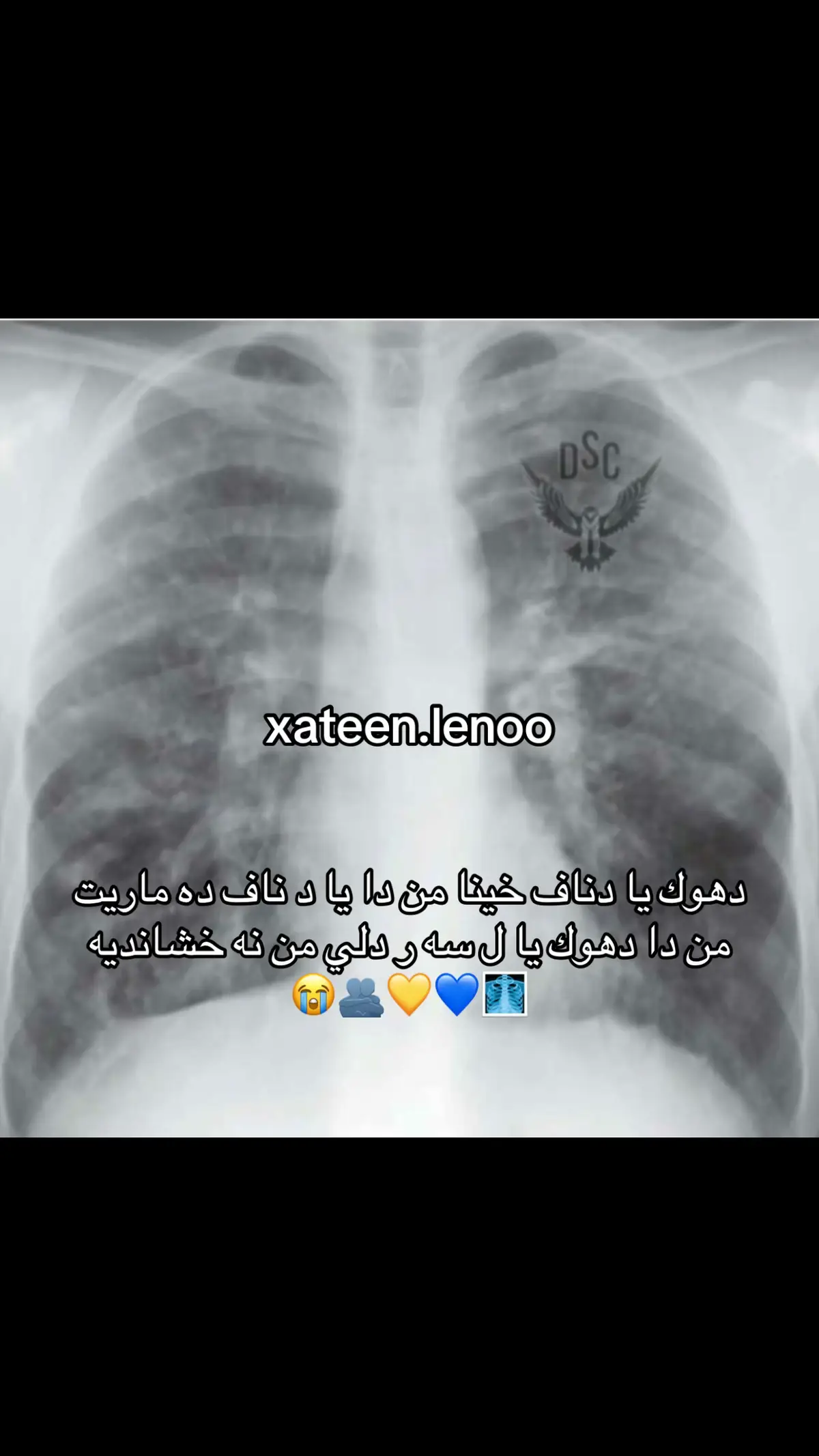 #xateen_lenoo 