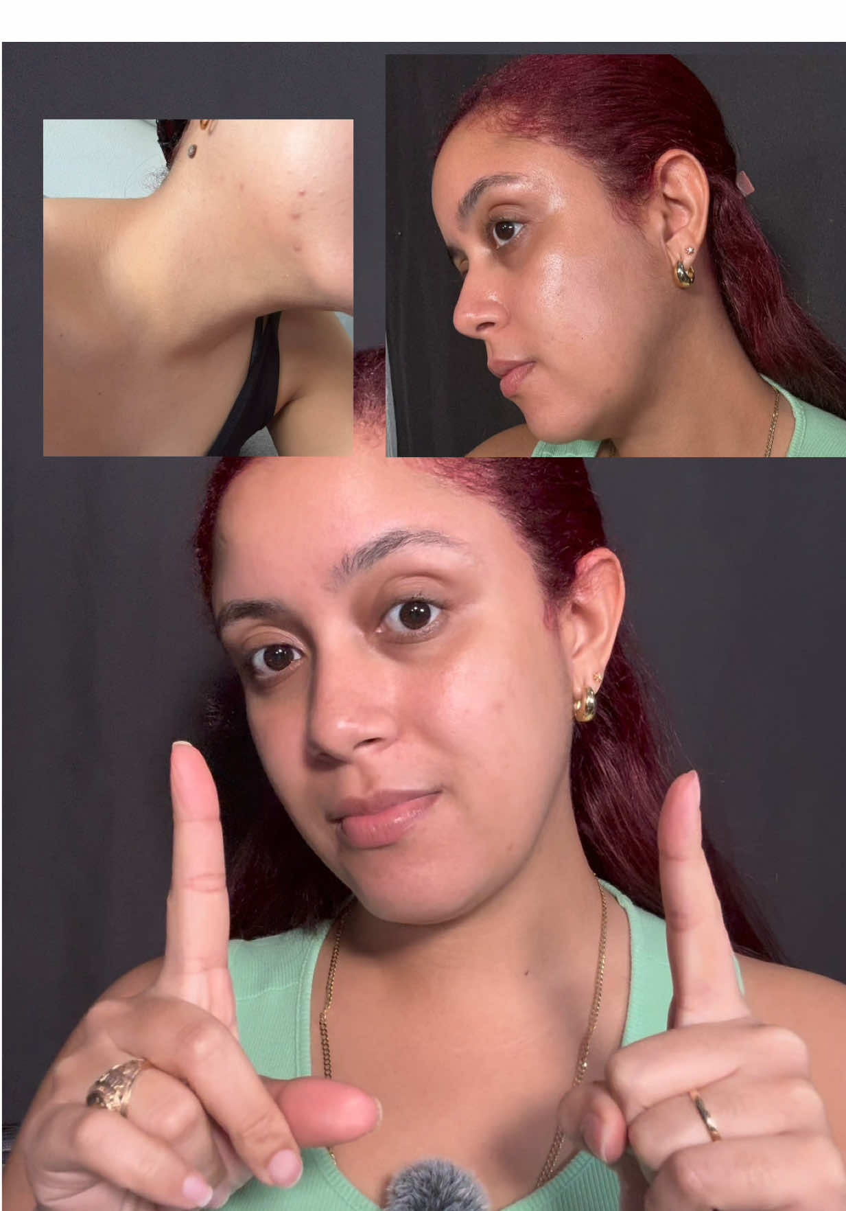 La calma que mi piel necesitaba 💚 @Dr. G #drg #Dr.g #RedBlemish #Dermatology #acne @Picky KBeauty 