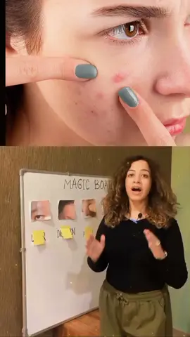 ان چھ چیزوں کا خیال رکھیں اور اپنے چہرے کو صاف رکھیں _sonianarangsdietclinics _healthydiet _skincare _nutrition Heart kindny Lungs Liver Digestion  ہارمون #healthylifestyle #fyp #viral #heart #Lifestyle 