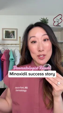 #stitch @Boo In this episode of Detangling Hair Loss, we’re talking minoxidil success stories. It’s not an overnight fix — you need to stay consistent for at least 3–6 months before seeing real results. Minoxidil works by extending your hair’s growth phase and reactivating dormant follicles. The “dread shed” you see early on? Totally normal. It means the treatment is working and old hairs are making way for new ones. If you’re using minoxidil, keep going. The progress might be slow, but your hair is working hard behind the scenes. #detanglinghairloss #spillingtheteawithmd