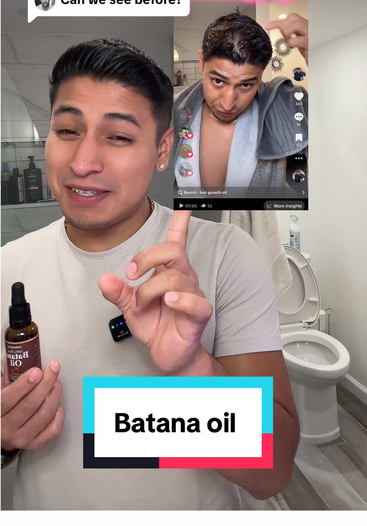 Replying to @Eran  People spend hundreds trying to fix their hair—yet sleep on Batana Oil, the ancient secret that actually works. 🌿✨ Restore shine, strength, and thickness… naturally. #B#BatanaOilH#HairGrowthSecretN#NaturalHairCareH#HealthyScalpShineWithNature