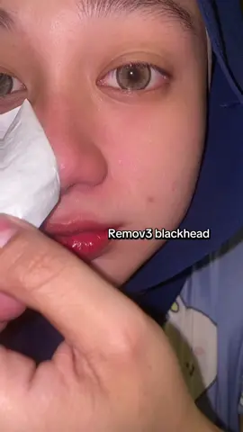 Hitam” dah xde lepas ni #lanbena #lanbenablackheadsremover 