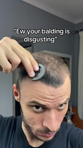 That’s the reality… 