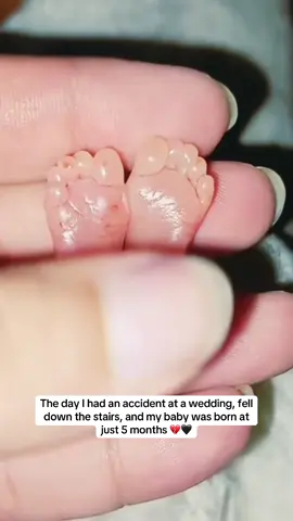 💔😭😭 #baby #hospital #pregnant 