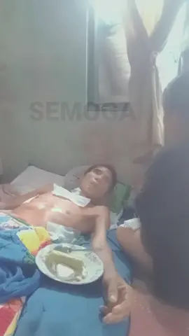 Alhamdulillah aku bersyukur engkau telah keluar dari ruang ICU sebulan lebih lamanya, kau sudah diberi kesempatan hidup lagi yang kedua kalinya, kau telah mampu melewati semua rasa sakitnya mulai dari masa kritis hingga pasca operasi dan belum lama ini sudah diperbolehkan untuk pulang dan berkumpul lagi bersama keluarga, meskipun masih dalam perawatan dan pengawasan dirumah, aku menyesal karena tidak tau tentang engkau yang telah mengalami kecelakaan kerja, aku habis