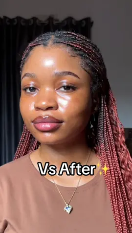 THE DIFFERENCE IS OBVIOUS!❤️ #koreanskincare #darkspots #hyperpigmentation #acnescar #skincare 