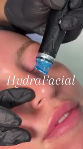 🌴✨ After enjoying the sun and sea in Samui, give your skin a refreshing break with our HydraFacial Treatment at Samui Beauty Club 💧 This luxurious treatment deeply cleanses, hydrates, and rejuvenates your skin leaving it soft, smooth, and glowing again ✨ Perfect for tired or sun-exposed skin after island adventures 🌞💆‍♀️ Relax, refresh, and let your natural glow shine through at Samui Beauty Club 🌺 #SamuiBeautyClub #HydraFacialSamui #FacialTreatmentSamui #HydrationFacial #KohSamui   