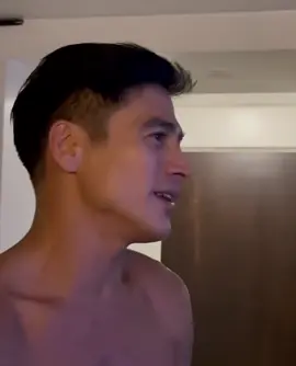 Stitches And Burns - Piolo Pascual #piolopascual #piolosnation #celebritysevolution 