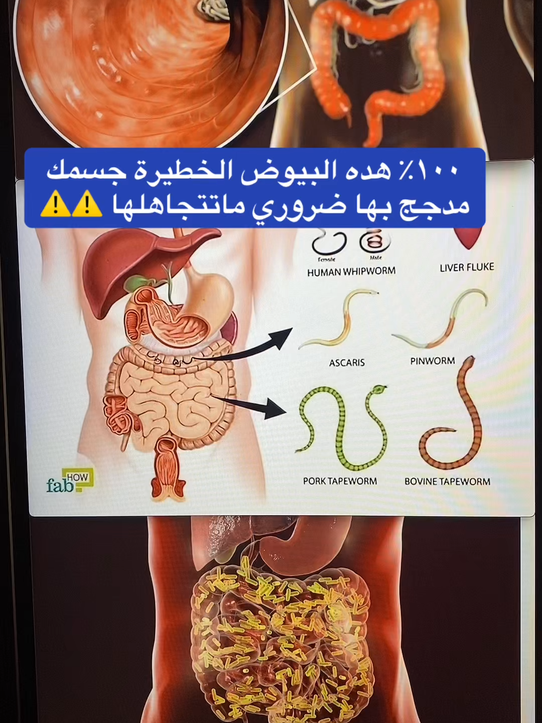 #قولون_هضمي #إمساك #خمول #93saudinationalday #إنتفاخ_القولون #الرياض_الآن🇸🇦🇸🇦 #مكة_المكرمة_السعودية #قولون_معدة_غازات_إنتفاخات_إمساك_حموضة #الدمام #الرياض_جده_مكه_الدمام_المدينه #السعودية_الكويت #توعية_صحية #الرياض_الان #إمساك_مزمن #قولون #قولون_تقرحي #إرتجاع_المرئ #إنتفاخ_البطن_والأمعاء #إنتفاخ_البطن