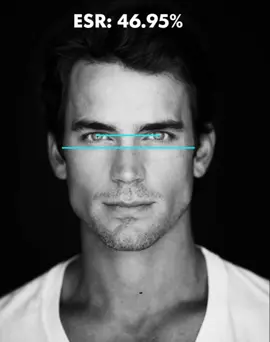 Insane Harmony #facialanalysis #Harmony #mattbomer #mog #looksmax #lookism #mogging #bp