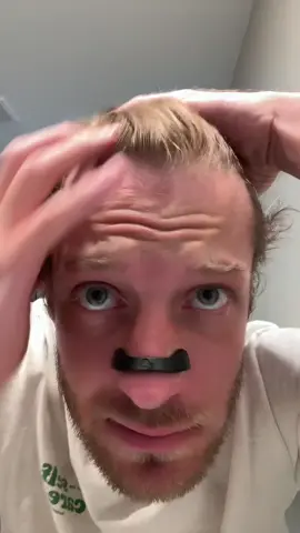 Black Friday deal on this hair growth serum roll on 