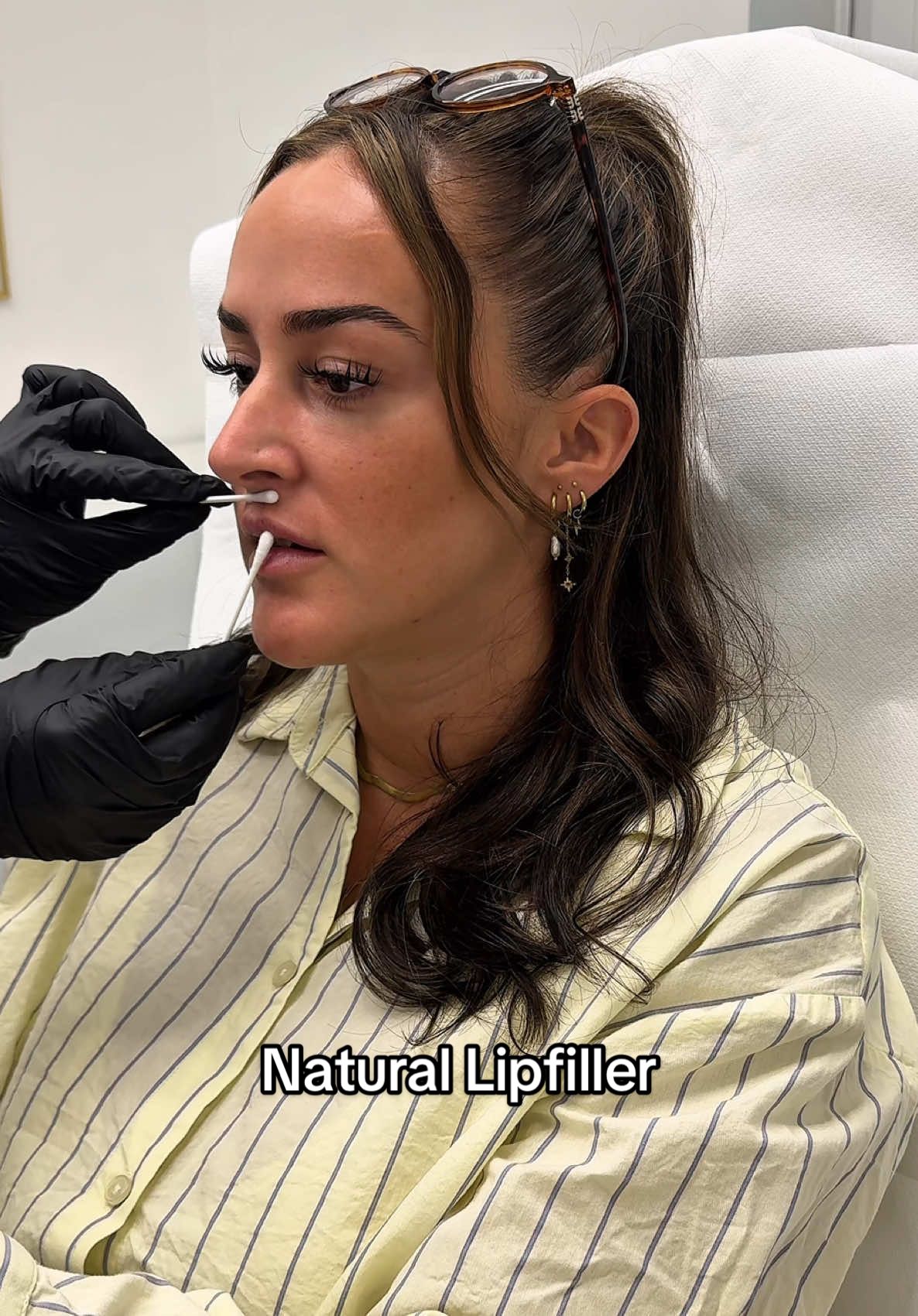 Beste Beratung, die ich je hatte 🙏🏼 📍@Zizi Aesthetics, Düsseldorf  #lipfiller #hyaluron #lippenaufspritzung #beautyhacks #glowupjourney 