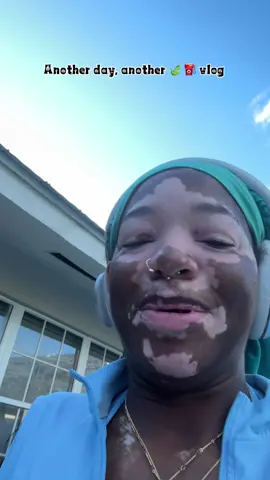 #fyp #vitiligo #Vlog #eddy 