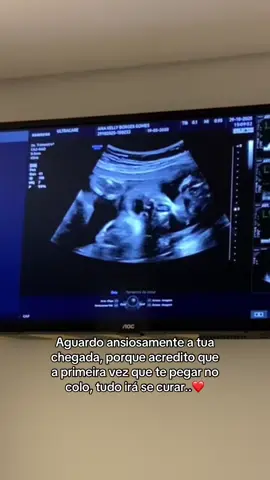 Minha menininha 🩷 #gravida #viral #fyp #gravidasnotiktok #maeprimeiraviagem 