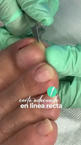 Aprende este truco y muchas más! Sígueme en mi perfil y nos vemos en el siguiente video 😍🤗 #pedicura #onicomicosis #podologia #quiropodia #flypシ 