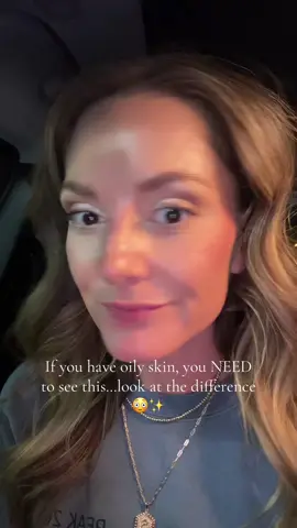 I’m literally obsessed at how well this works! #oilyskin #oilyskincare #oilyskinmakeup #oilyskinproducts #oilyskintips 
