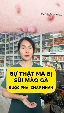 Sự thật mà ai bị sùi phải chấp nhận #xuhuong #suimaoga #sùi_mào_gà #sùi #daothaihpv 