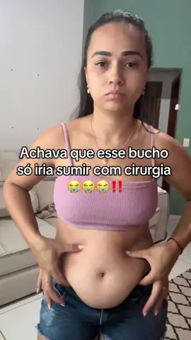 Sem cirurgia meninas eu consegui 🥲😍😍#flacidez #cremerosa #estrias #brasil 