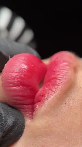 Môi bong vảy li ti lên tone màu trong veo ntn đã đủ Wow ko ạ 🥰 #vyanhbeauty #tiệmdachữalành #khuthammoi #phunmoi #pmu #viral #tiktok #phunxamthammy 
