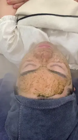 Peel xong khách mê #peelda #duocmypham #cangbongda #peeltao #lamdep 