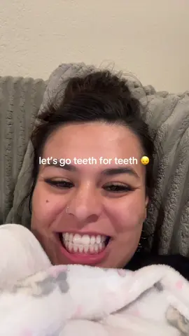 my shiny teeef & meee  #fyp #teeth #teethtok 