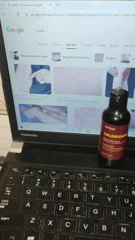 Galinggang Oil Arbaplus Minyak Balur untuk inspeksi kulit 