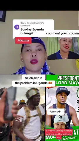 ####allien skin is the problem in Uganda 🇺🇬.  commentinga obuzibu bwona nkuyambe mukwano fyppppppp...