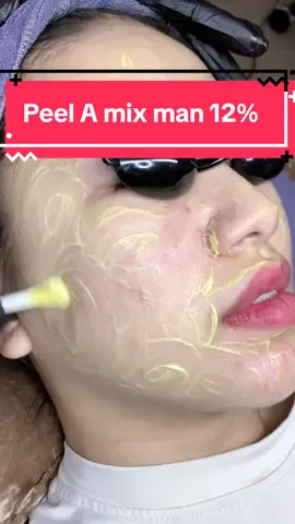 Peel A mix man 12%#peeltrang #cháypeel #spadanang #túdoli #peelda 