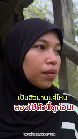 เคยเป็นสิวหนักสุดนานแค่ไหน มาชาอัลลอฮ 💚💚💚#สบู่ว่านนางพญาหน้าขาว #หัวเชื้อกลูต้าซีไฮยา #สบู่ว่านนางพญาหน้าขาว 