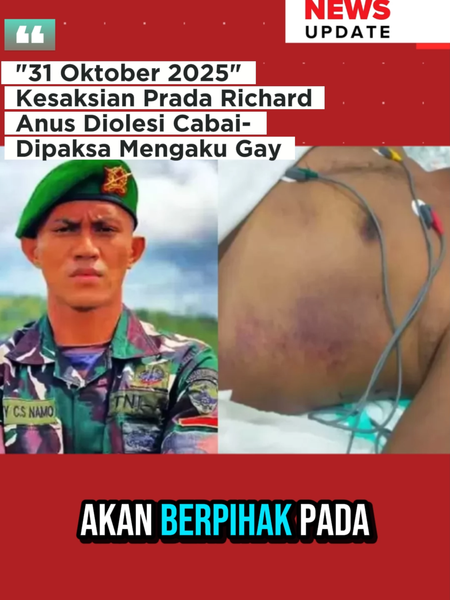 Kesaksian Prada Richard Anus Diolesi Cabai-Dipaksa Mengaku Gay. Kesaksian mengejutkan muncul dalam sidang kematian Prada Lucky. Saksi mengaku disiksa secara keji oleh atasannya, dipaksa telanjang, hingga diolesi cabai di area sensitif hanya agar mengaku LGBT. Tuduhan itu belakangan terbukti cuma asumsi tanpa bukti. Keadilan untuk Prada Lucky dan korban lain kini jadi sorotan publik. #PradaLucky #KeadilanUntukLucky #SidangMiliter #TNI #HukumIndonesia #PradaRichard #Kekerasan #ViralHariIni #BeritaPanas #BreakingNews #SuaraRakyat #Kemanusiaan #IndonesiaUpdate #SkandalMiliter