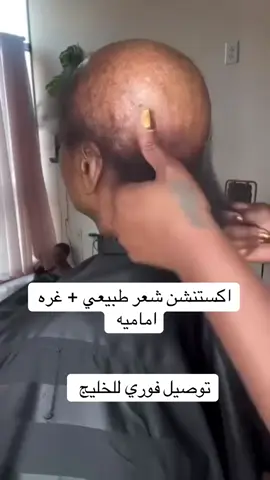 #🇦🇪00971581793112واتساب #عمان_قطر_السعوديه_البحرين_الكويت #دول_الخليج_العربي🇯🇴🇰🇼🇸🇦🇦🇪🇶🇦 #تركيب_جميع_انواع_الشعر_الطبيعي 