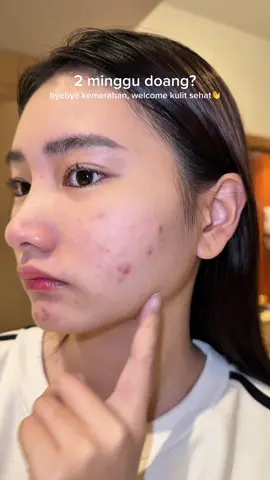 mau hilangin kulit kemerahan malah dapet bonus glowing🤫#moisturizer #elformula #sensitiveskin 