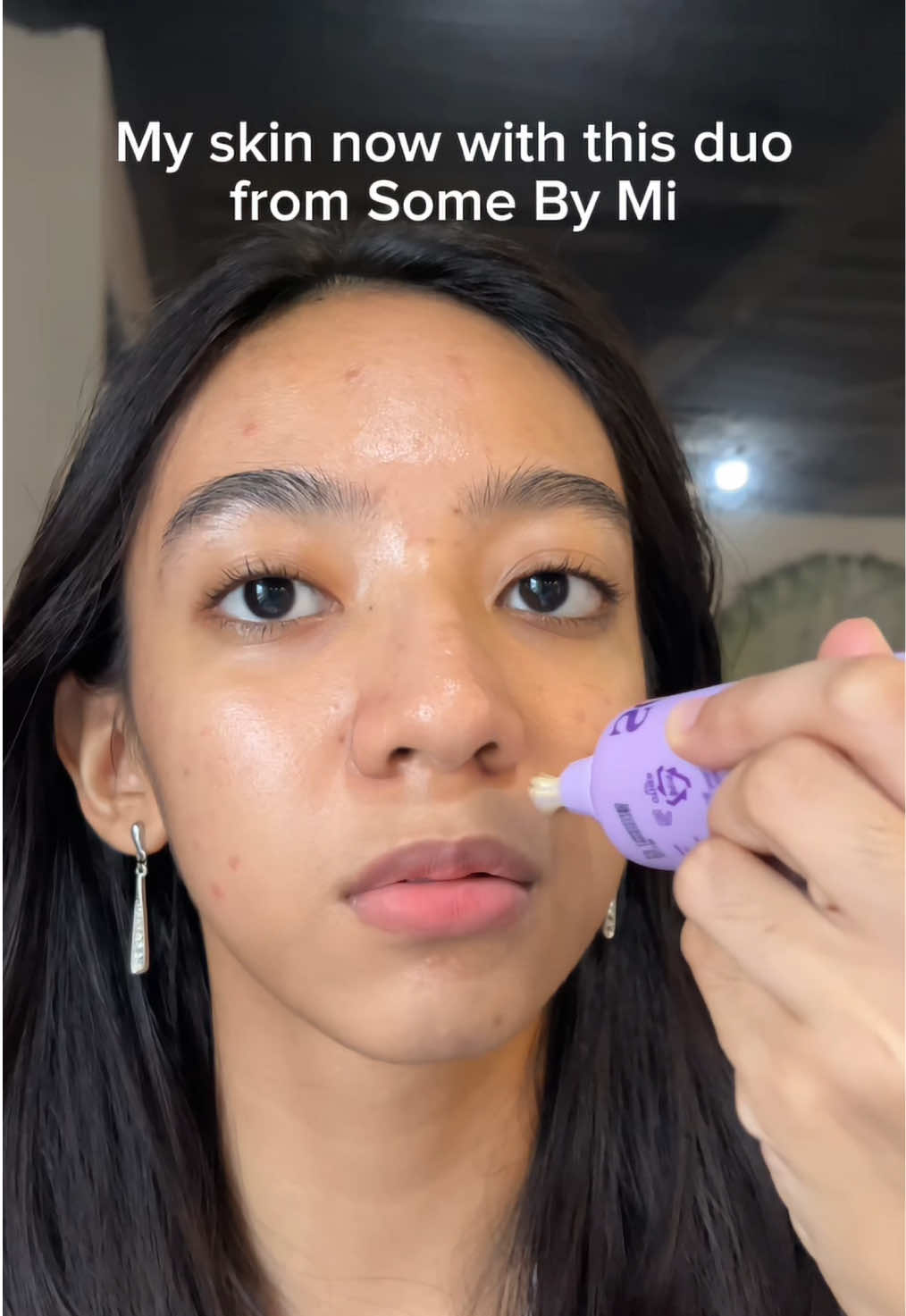 Using the Retinol Duo from Some By Mi changed my skin entirely #somebymi #retinol #acneprone #poretigntening #smoothskintexture @Some By Mi Philippines @SOME BY MI US 