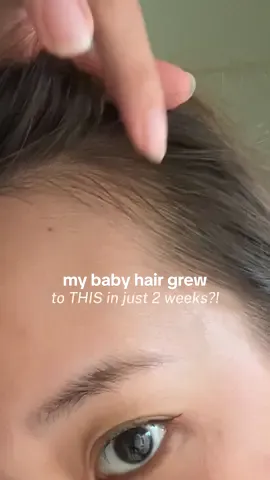 my baby hairs are finally back 🥹✨ used the @celladix_sg Hair Boosting Serum with biotin, keratin & tea tree — lightweight, non-greasy, and actually works 💧 #Celladix #celladixhairscalpserum #babyhair