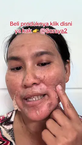 BELI PRODUK DAN KERANJANG KUNINGNYA KLIK DI SINI YA KAK 👉 @Soraya2 