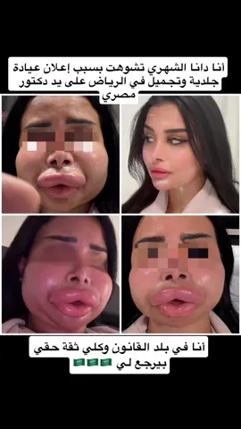 يارب شافيني و عافيني دعواتكم 🙏🏻 #khobar #riyadhseason #explore #تجميل #الشعب_الصيني_ماله_حل😂😂 