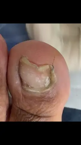 nails #nailsalon #nailtech #nail #nails #nailart 