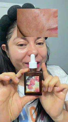 #vitaminacserum #draltheavitamincserum #draltheaglobal #draltheavitamincboostingserum #draltheavitaminc @dr.althea_es 