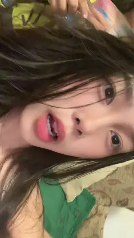 May sugat payan sa ilong#fyourpage #viral #trwnding #tiktok #avellana 