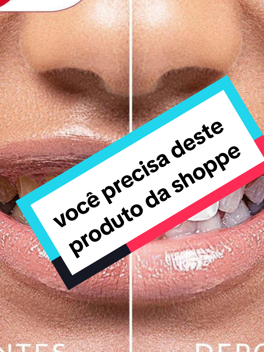 você precisa deste produto da shoppe  Caneta Branqueadora Colgate Luminous White 2,5ml #autocuidado #colgate #canetabranqueadora  link no comentário aproveita a promoção relâmpago 