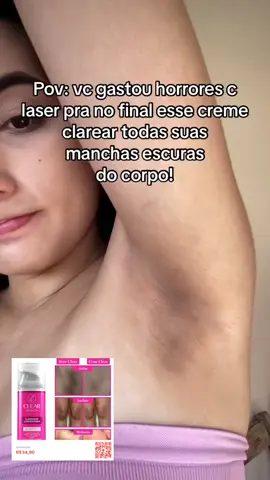 Dê uma olhada em Clareador de virilha e axila Creme Clareador Partes Intimas - Clear Beauty por R$28,70. Compre na Shopee agora! 🚨É SÓ COPIAR E COLAR O LINK 🚨👇🏼    https://s.shopee.com.br/4VUcHdL3SI #afiliados #shopee #clariamento 