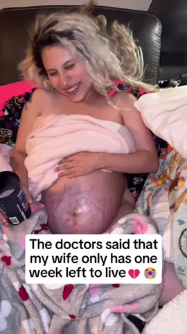 Ever wonder what it’s like to be told your wife has one week left to live? 😢 Here’s what those days really looked like: 🏥 Sleepless nights beside her hospital bed 💭 Stress, fear, and prayers every hour 💧 Energy gone, body breaking down 💪 One thing that helped me stay strong? PHM Hydrogen Water Tubes 💧 They kept me hydrated, focused, and calm through it all. Now, I’m still standing — for my boys, and for her. 💙 #USA #FYP #ViralContent #TikTokMadeMeBuyIt #TrendingNow