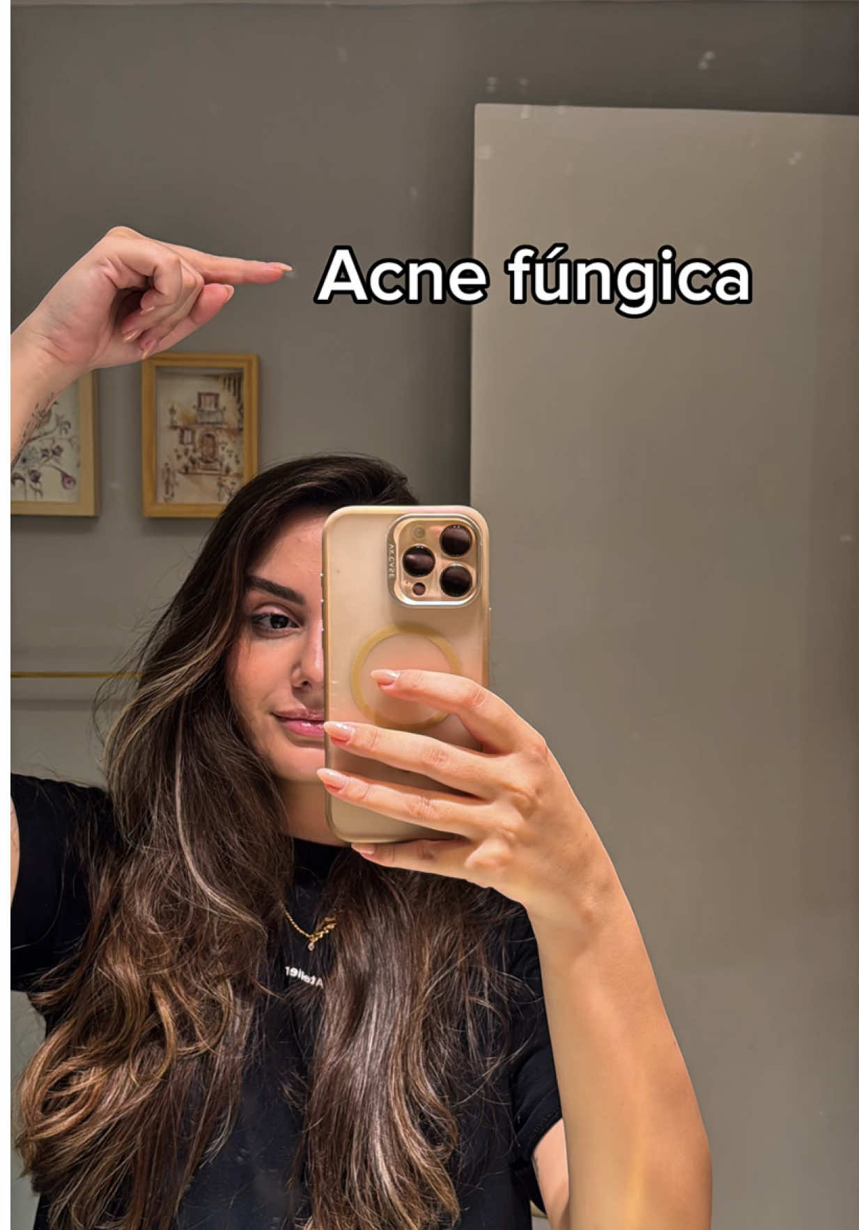 Tratamento para acne fúngica ⚠️✨ Vídeo explicando melhor sobre como identificar acne fúngica na pele e qual é o melhor tratamento! 🩷 #pele #rotinadepele #acnefungica #acne #peleacneica   
