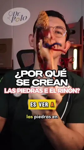 Cuida tu salud con Sotne dissolver plus 🔥 envío gratis a todo Colombia #enviogratis #colombia #fyp #renal 