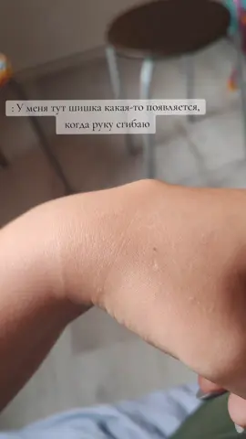 просто откройте следующее видео... #гигрома #операция 