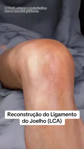 Reconstrução do Ligamento do Joelho #cirurgia #viraltiktok  #fyp  #drjosecelso 